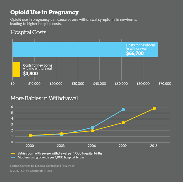 Opioid use in pregnancy Opioid use in pregnancy