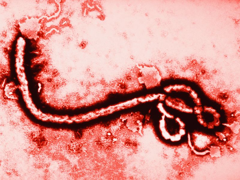 Ebola: Obamacare’s Ultimate Pre-Existing Condition