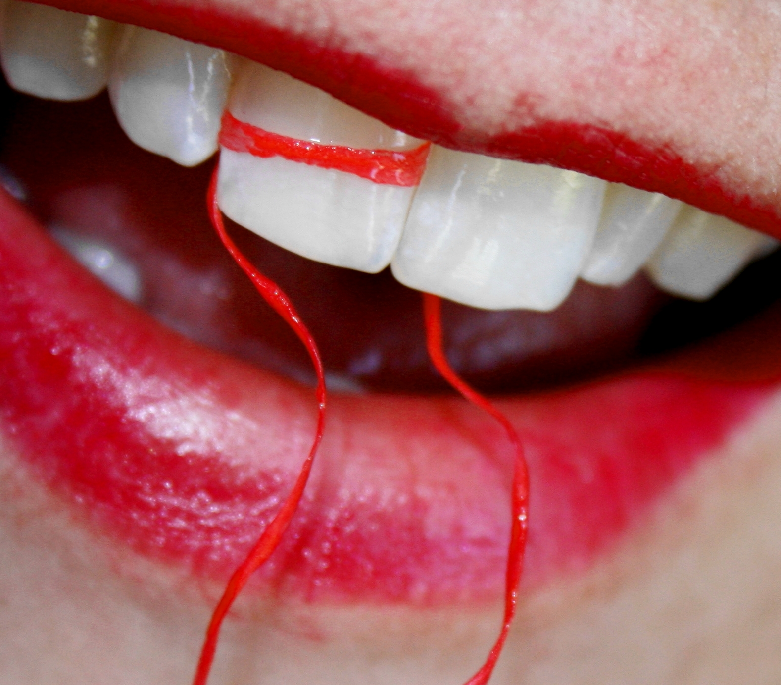 The Flossing Controversy, Explained